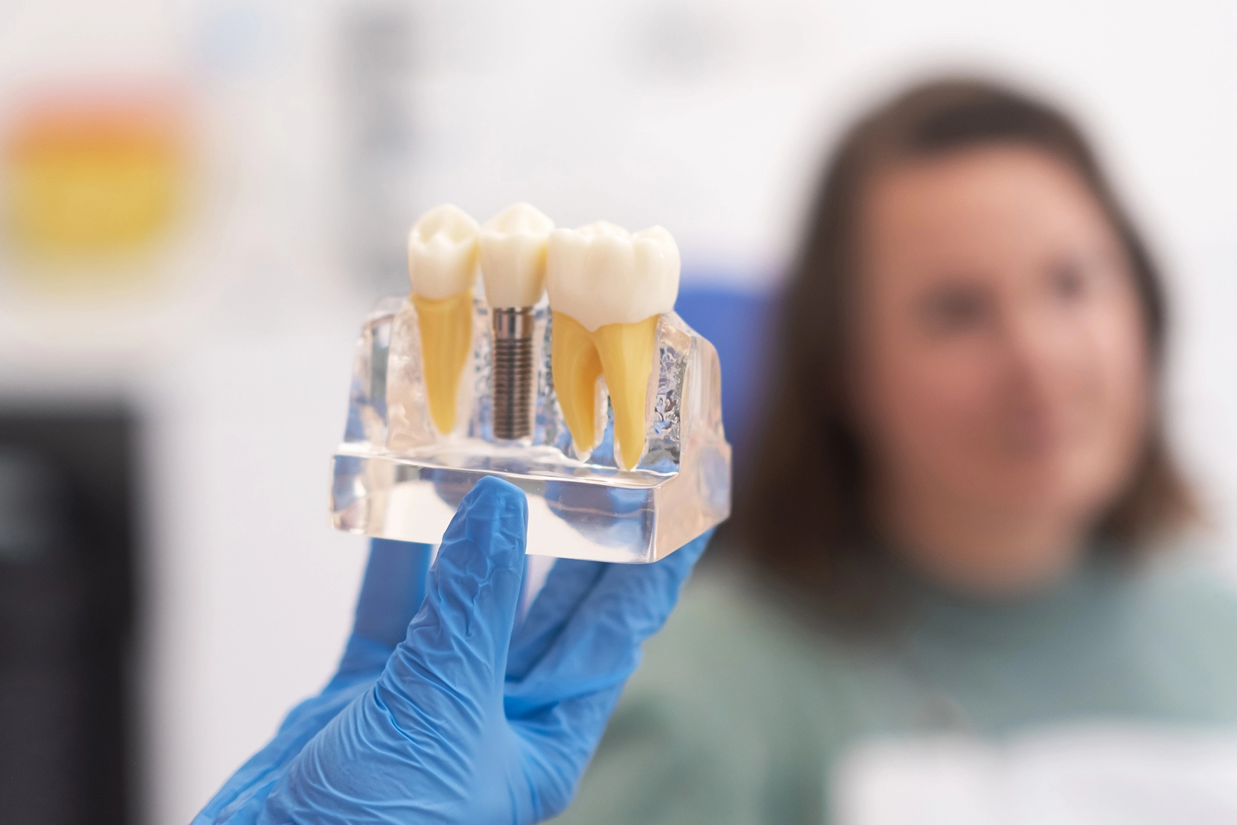 Dental Implants: Secrets to Long-Lasting Success