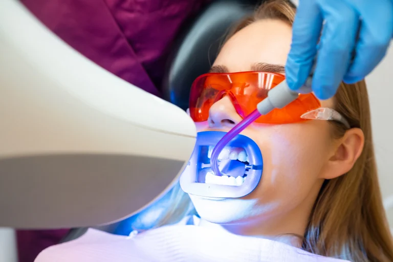 Tooth Bleaching in Antalya