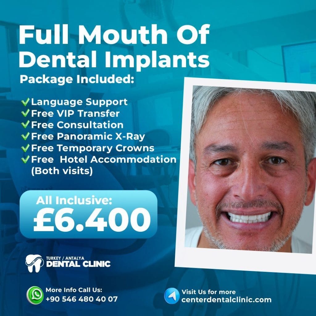 Full Mouth Dental Implant in antalya Turkey