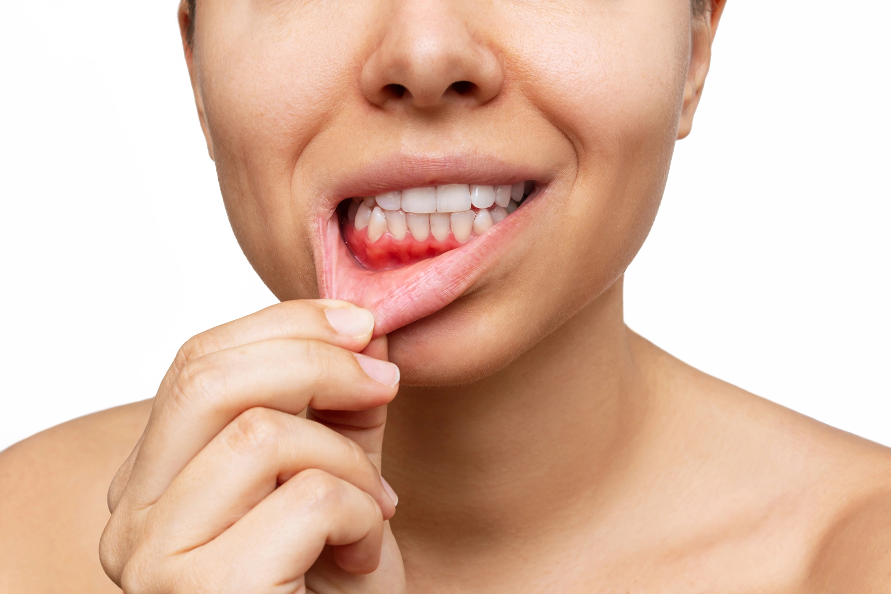 How to Stop Bleeding Gums: 7 Simple Remedies That Work