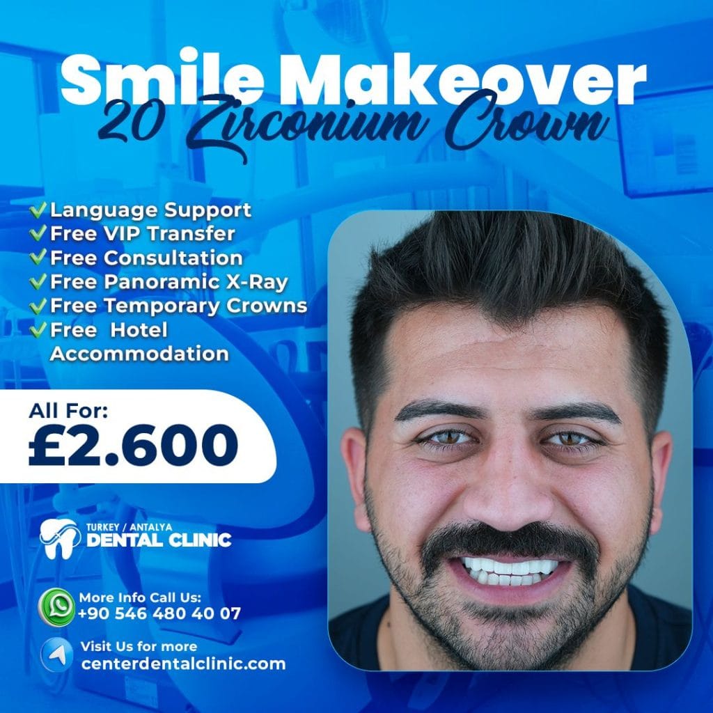 Smile Makeover