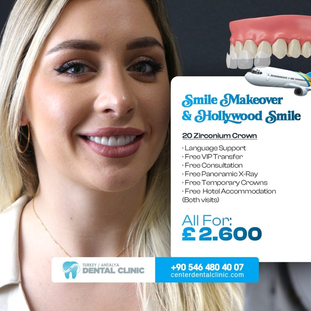 Smile Design in Antalya Turkey