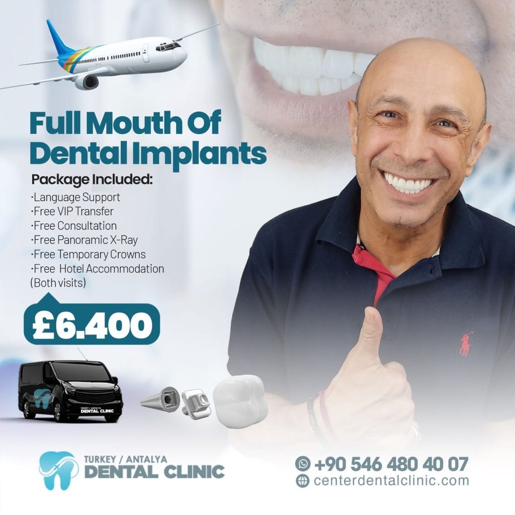 implant-in-antalya-turkey (1)