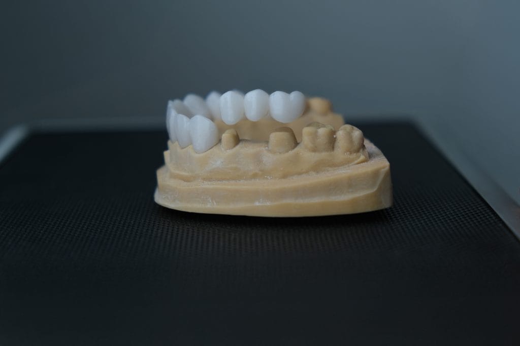 Dental Crowns in Antalya Turkey