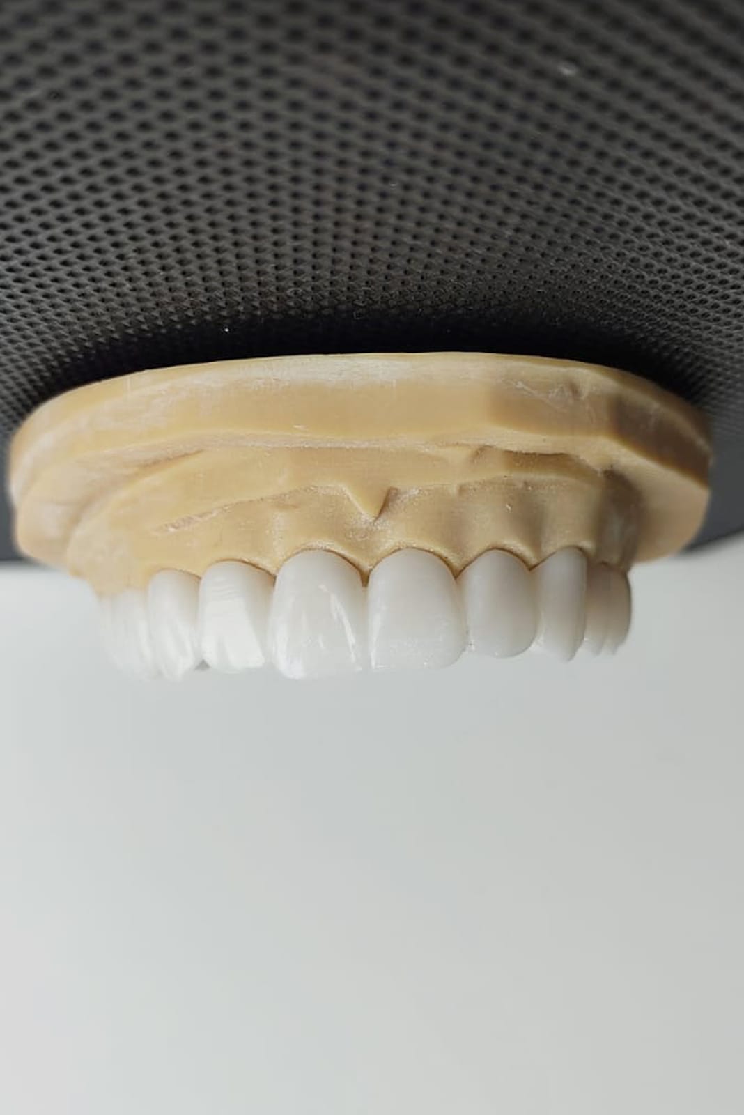 Porcelain Crowns in Antalya Turkey