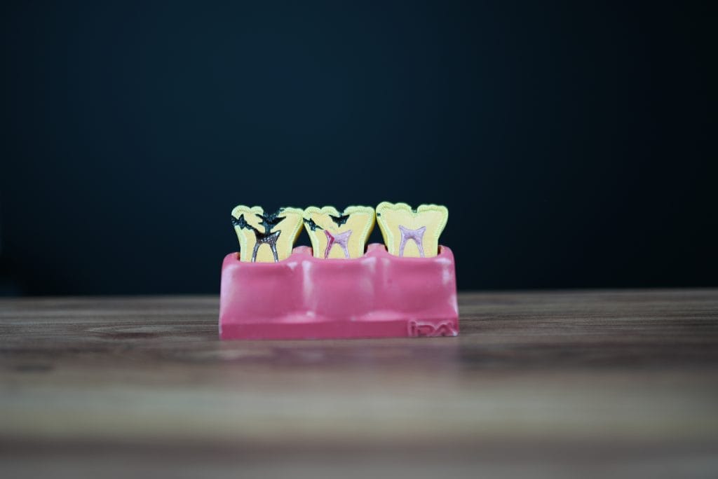 Dental Root Canal Treatment in Antalya Turkey