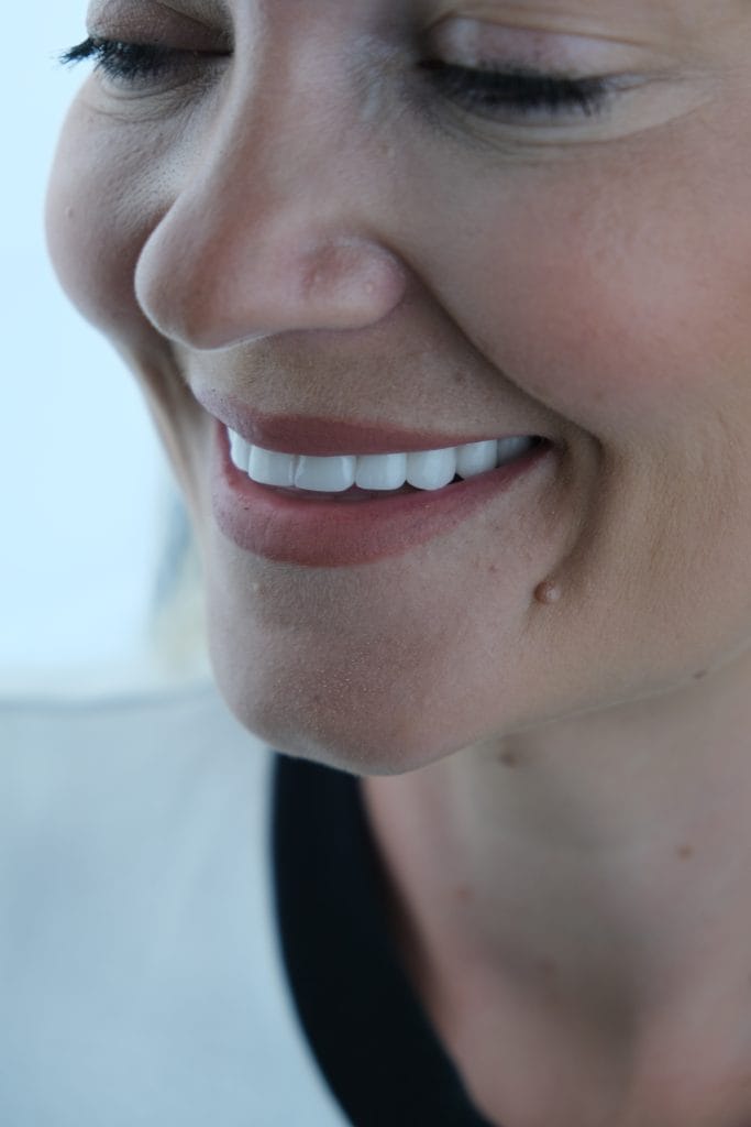 laminate veneer turkey | Aesthetic Dentistry Antalya Turkey