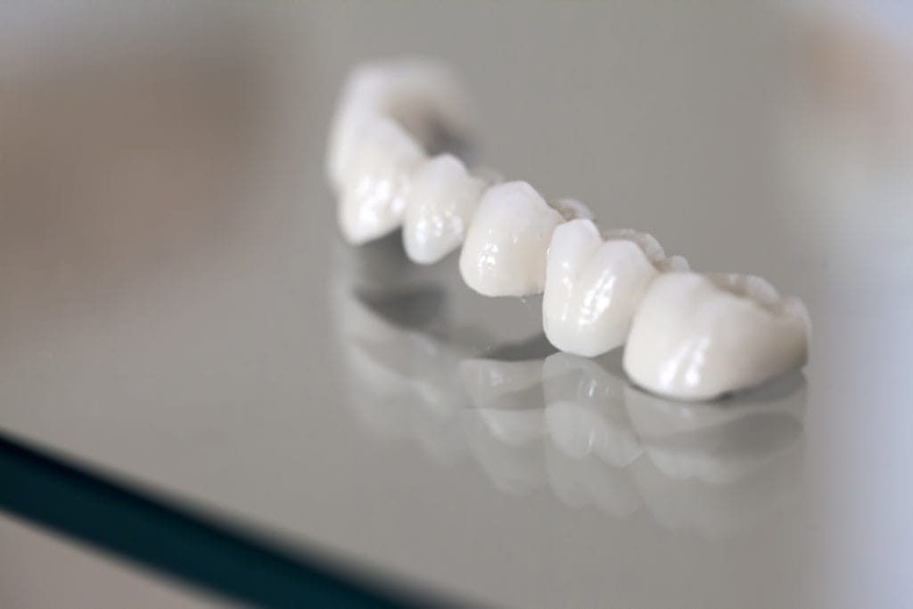 Porcelain Crowns in Antalya Turkey