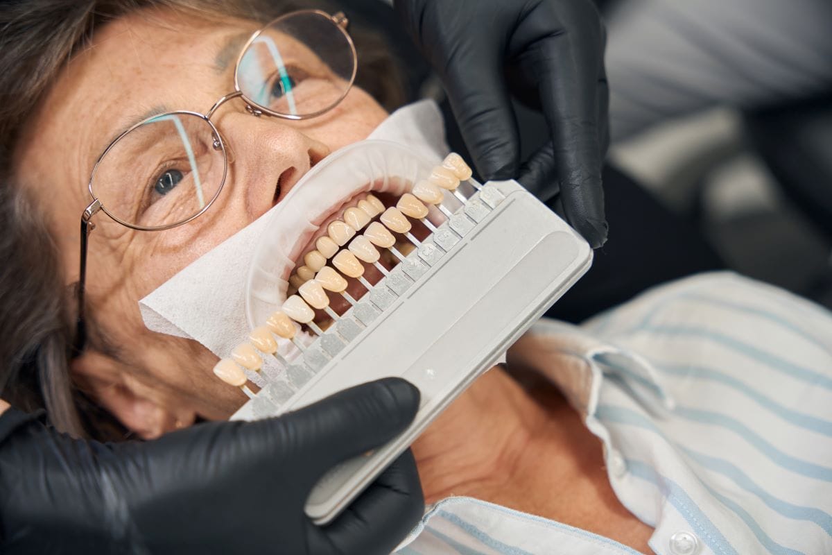 Dental Crowns Turkey Guide: Costs, Benefits, and What to Expect