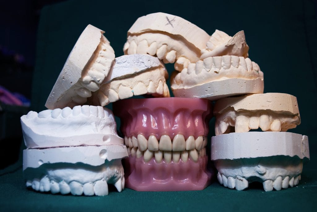 Different types of Dental Implants in Turkey