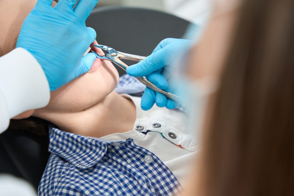 tooth extraction in Antalya Turkey