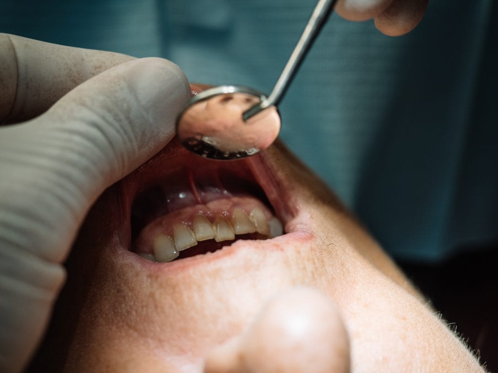 gum disease treatment in Antalya turkey