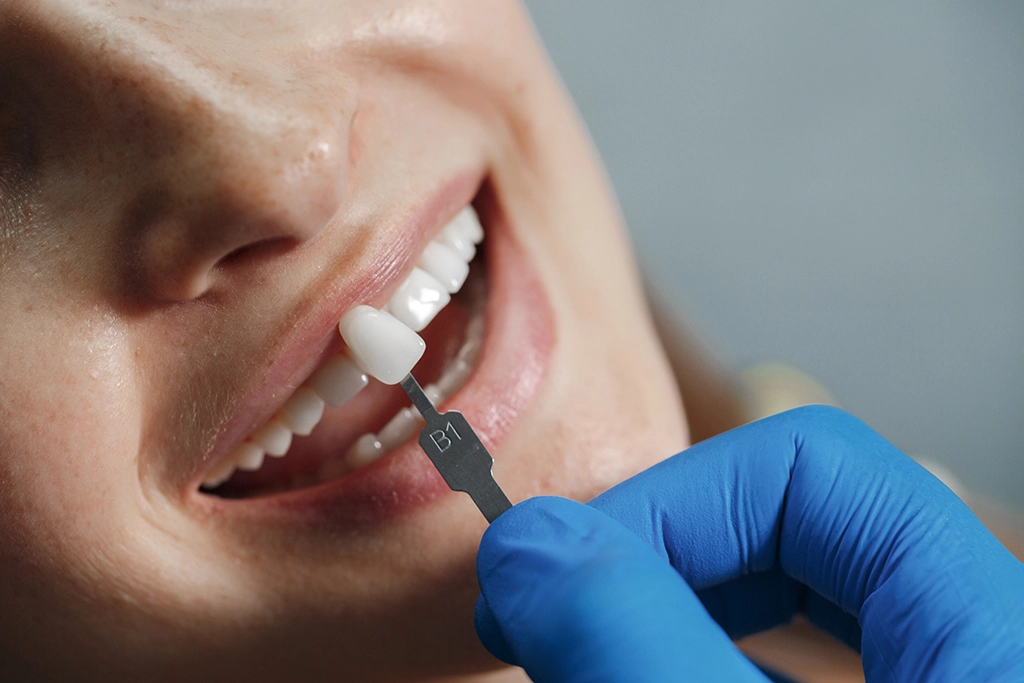 Dental Implants Hungary Helvetic Clinics