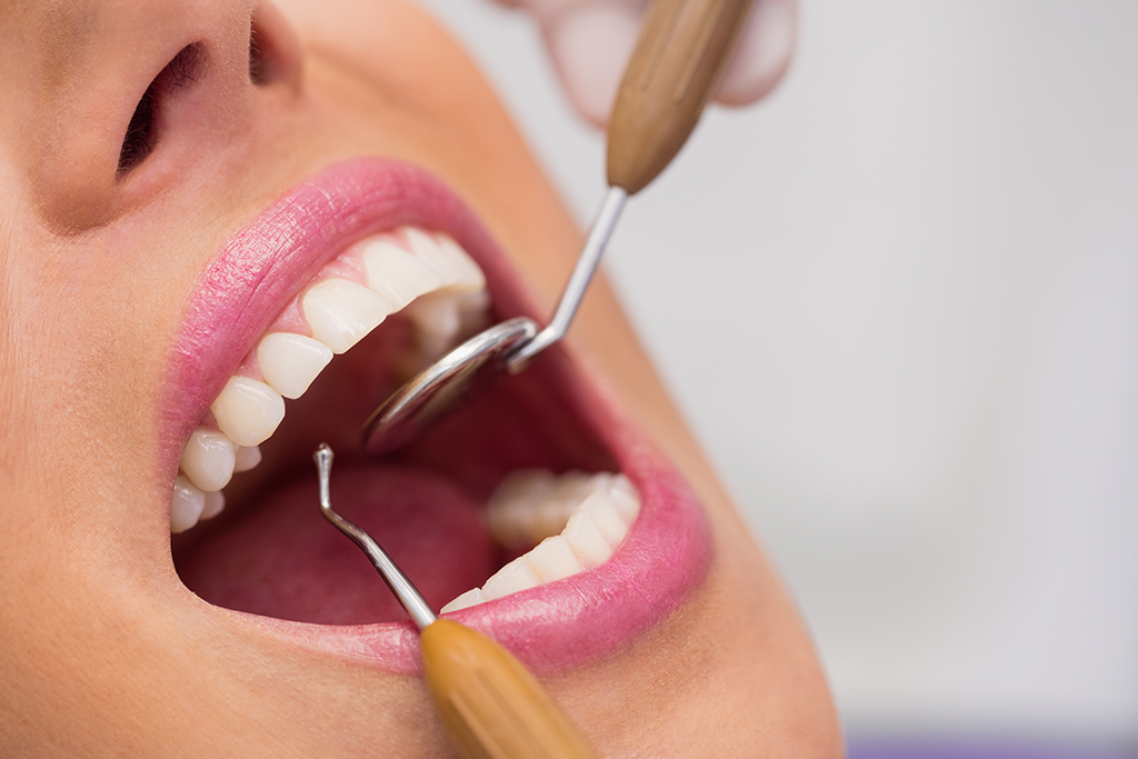 Turkey Teeth UK – Affordable & Safe Dental Care